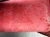 Dynapac CA152D Foto 11 thumbnail